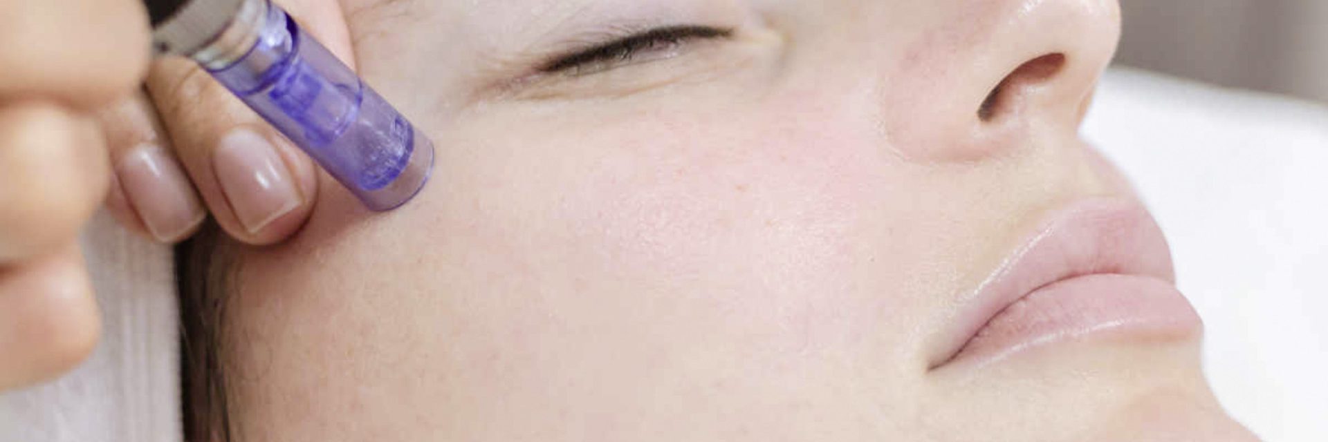 microneedling--cover